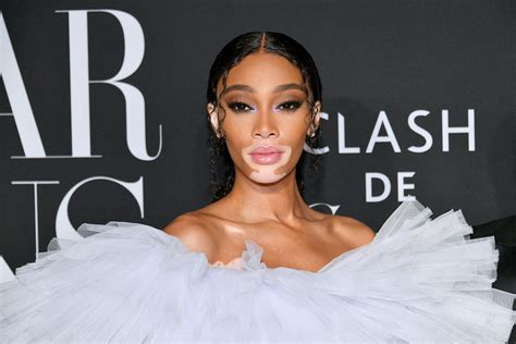 Winnie Harlow Net Worth 2024: What Is The Model。